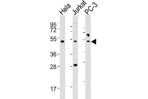 All lanes : Anti-NFKBIE Antibody (Center) at 1:2000 dilution Lane 1: Hela whole cell lysates Lane 2: Jurkat whole cell lysates Lane 3: PC-3 whole cell lysates Lysates/proteins at 20 μg per lane. (NFKBIE anticorps  (AA 191-224))