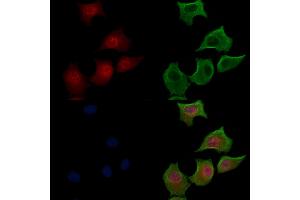 Phospho-FOXO3A (Ser318/Ser321) Antibody staining HepG2 cells(serum starvation treatment) by IF/ICC.
