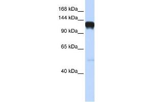 Eph Receptor A5 antibody used at 1 ug/ml to detect target protein. (EPH Receptor A5 anticorps  (Middle Region))