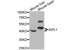 Western blot analysis of extracts of various cell lines, using AIPL1 antibody (ABIN5973857) at 1/1000 dilution.