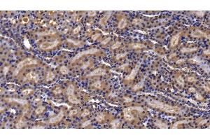 Detection of IkBa in Rat Kidney Tissue using Polyclonal Antibody to Inhibitory Subunit Of NF Kappa B Alpha (IkBa)