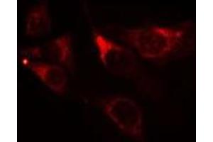 ABIN6275540 staining NIH-3T3 cells by IF/ICC. (TAO Kinase 1 (TAOK1) (Internal Region) anticorps)