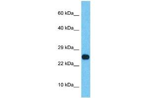 Host:  Rabbit  Target Name:  SSX2B  Sample Type:  Thyroid Tumor lysates  Antibody Dilution:  1. (Synovial Sarcoma, X Breakpoint 2B (SSX2B) (N-Term) anticorps)