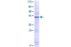 Image no. 1 for Lipoma HMGIC Fusion Partner (LHFP) (AA 1-200) protein (GST tag) (ABIN1309364)