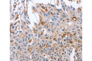 Immunohistochemistry (IHC) image for anti-Neuregulin 4 (NRG4) antibody (ABIN2828341) (Neuregulin 4 anticorps)