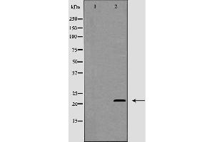 Western blot analysis of MGMT expression in Jurkat cells. (MGMT anticorps  (N-Term))