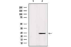 Western blot analysis of extracts from Mouse liver, using ICT1 Antibody. (ICT1 anticorps)