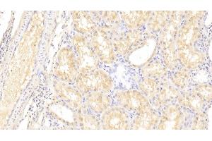 Detection of LOXL3 in Human Kidney Tissue using Polyclonal Antibody to Lysyl Oxidase Like Protein 3 (LOXL3)