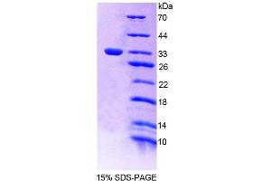 SDS-PAGE analysis of Rat PLCd4 Protein. (PLCD4 Protéine)