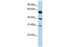 Image no. 1 for anti-LysM, Putative Peptidoglycan-Binding, Domain Containing 4 (LYSMD4) (AA 35-84) antibody (ABIN6741208) (LYSMD4 anticorps  (AA 35-84))