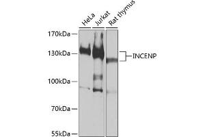 Western blot analysis of extracts of various cell lines, using INCENP antibody (ABIN6130494, ABIN6142441, ABIN6142442 and ABIN6213904) at 1:1000 dilution. (INCENP anticorps  (AA 785-914))