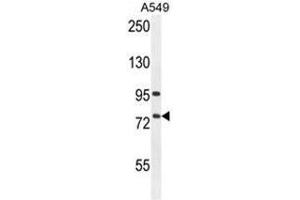 ALOX12B Antibody (C-term) western blot analysis in A549 cell line lysates (35µg/lane). (ALOX12B anticorps  (C-Term))
