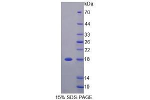 SDS-PAGE analysis of Rat TNFRSF25 Protein. (DR3/LARD Protéine)