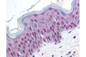 Image no. 2 for anti-High Mobility Group Nucleosome Binding Domain 1 (HMGN1) (AA 19-28), (pSer20), (pSer24) antibody (ABIN401321)