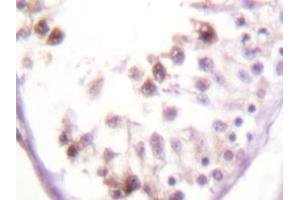 Immunohistochemistry analyzes of HDAC6 antibody in paraffin-embedded human testis tissue. (HDAC6 anticorps)