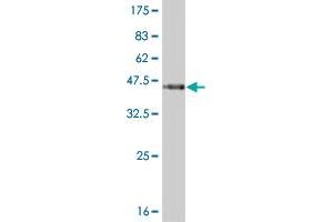 Western Blot detection against Immunogen (36. (PKNOX1 anticorps  (AA 2-100))