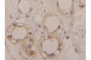 Detection of GAPDH in Human Kidney Tissue using Polyclonal Antibody to Glyceraldehyde-3-Phosphate Dehydrogenase (GAPDH) (GAPDH anticorps  (AA 154-324))