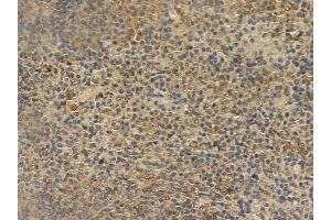 SLP76 Mouse Monoclonal Antibody at 1/100 staining mouse spleen tissue by IHC-P.
