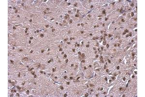 IHC-P Image NFIB antibody [N1C2] detects NFIB protein at nucleus on mouse fore brain by immunohistochemical analysis. (NFIB anticorps)