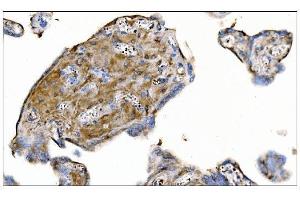 IHC analysis of MERTK using anti-MERTK antibody (ABIN7600623). (MERTK anticorps  (AA 21-489))