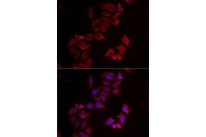 Immunofluorescence analysis of MCF7 cells using LIMS1 antibody (ABIN6132049, ABIN6143233, ABIN6143235 and ABIN6222007). (LIMS1 anticorps  (AA 1-325))