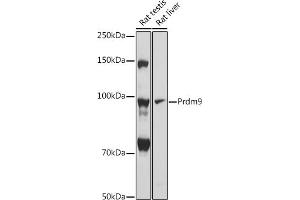 Western blot analysis of extracts of various cell lines, using Prdm9 antibody (ABIN7269502) at 1:1000 dilution.