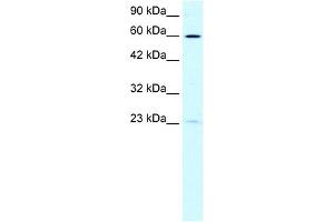 WB Suggested Anti-SUPT3H Antibody Titration: 0. (SUPT3H/SPT3 anticorps  (N-Term))