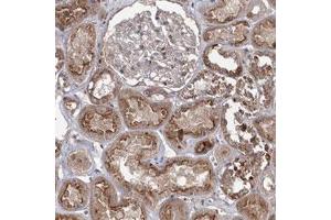 Immunohistochemical staining (Formalin-fixed paraffin-embedded sections) of human kidney with MAP3K13 polyclonal antibody  shows moderate membrane and cytoplasmic positivity in cells in tubules.