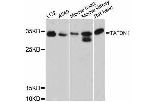 Western blot analysis of extracts of various cell lines, using TATDN1 antibody (ABIN5999010) at 1:3000 dilution. (TATDN1 anticorps)