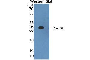 Western blot analysis of the recombinant protein. (IFNA2 anticorps  (AA 24-192))
