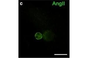 Immunofluorescence in cultured hDRG neurons.