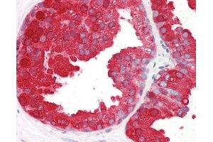 Anti-ACPP antibody IHC of human prostate. (ACPP anticorps  (AA 269-282))