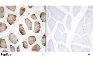 Immunohistochemistry analysis of paraffin-embedded human skeletal muscle using DUS2L polyclonal antibody . (DUSL2 anticorps  (C-Term))