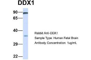 Host:  Rabbit  Target Name:  DDX1  Sample Type:  Human Fetal Brain  Antibody Dilution:  1. (DDX1 anticorps  (Middle Region))