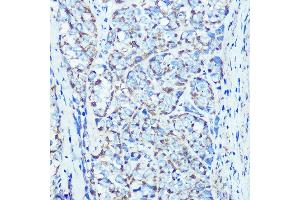 Immunohistochemistry of paraffin-embedded rat kidney using ATPB Rabbit mAb (ABIN7265722) at dilution of 1:100 (40x lens).