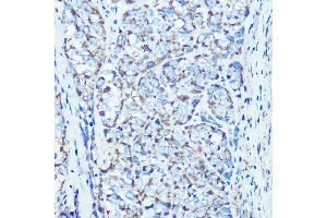 Immunohistochemistry of paraffin-embedded rat kidney using ATPB Rabbit mAb (ABIN7265722) at dilution of 1:100 (40x lens). (ATP5B anticorps)