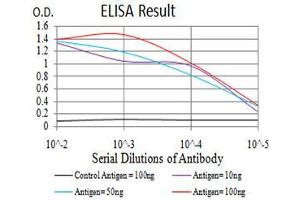 Black line: Control Antigen (100 ng),Purple line: Antigen (10 ng), Blue line: Antigen (50 ng), Red line:Antigen (100 ng)
