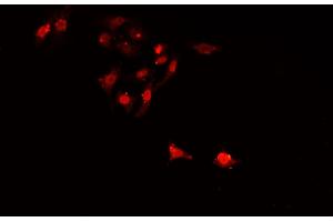 ABIN6268997 staining A549 cells by IF/ICC. (SIAH2 anticorps  (C-Term))