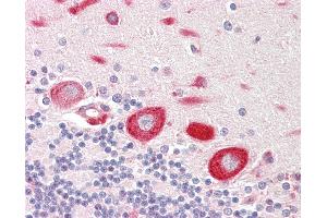 anti-MOB1, Mps One Binder Kinase Activator-Like 1B (MOBKL1B) (AA 167-216) antibody