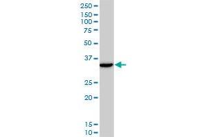 DLX5 monoclonal antibody (M12), clone 3B11.