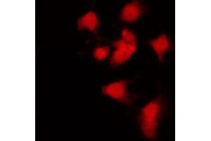 ABIN6269060 staining K562 by IF/ICC. (JAK2 anticorps  (C-Term))