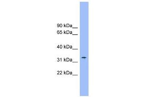 SLC25A1 antibody used at 1 ug/ml to detect target protein. (Slc25a1 anticorps)