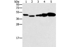 Western Blot analysis of Hela, Raji, Jurkat, A549 and NIH/3T3 cell using PPAT Polyclonal Antibody at dilution of 1:250 (PPAT anticorps)