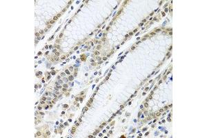Immunohistochemistry of paraffin-embedded human stomach using TIA1 antibody at dilution of 1:100 (40x lens). (TIA1 anticorps)