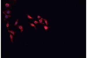 ABIN6266864 staining HepG2 cells by IF/ICC.