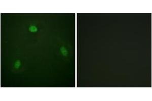 Immunofluorescence analysis of NIH-3T3 cells, using Pin1 (Ab-1619) Antibody. (PIN1 anticorps  (AA 1-50))