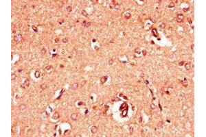 Immunohistochemistry of paraffin-embedded human brain tissue using ABIN7153965 at dilution of 1:100