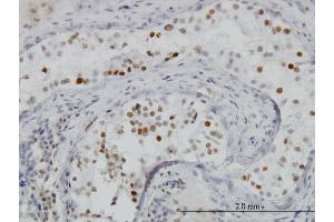 Immunoperoxidase of monoclonal antibody to BRD3 on formalin-fixed paraffin-embedded human testis.