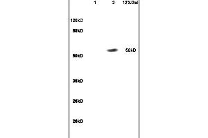Lane 1: mouse embryo lysates Lane 2: human colon carcinoma lysates probed with Anti RBPJK/RBP-J Polyclonal Antibody, Unconjugated (ABIN872972) at 1:200 in 4C. (RBPJ anticorps  (AA 101-200))