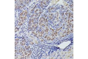 Immunohistochemistry of paraffin-embedded rat ovary using TET3 Rabbit pAb (ABIN6133174, ABIN6149021, ABIN6149023 and ABIN6223527) at dilution of 1:150 (40x lens).